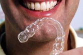 Invisalign